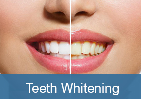 Teeth Whitening